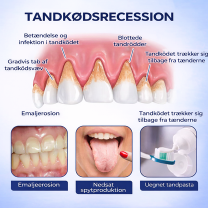 DentiCure™ – Tand- & Tandkødsstyrke