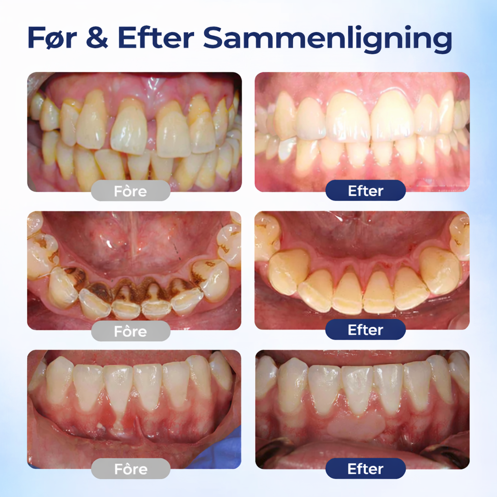DentiCure™ – Tand- & Tandkødsstyrke