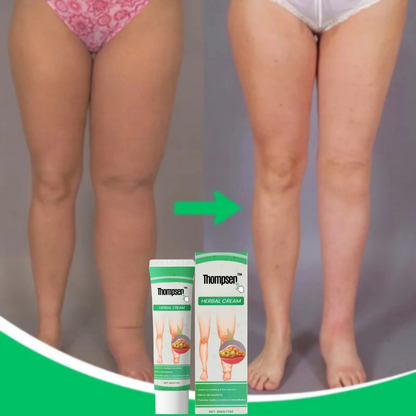 BodyBalance Cream™  | Reducerer hævelser i benene og væskeophobning med op til 92 % på 24 timer