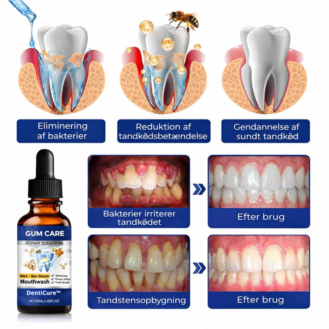 DentiCure™ – Tand- & Tandkødsstyrke