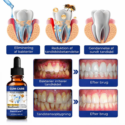 DentiCure™ – Tand- & Tandkødsstyrke
