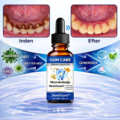 DentiCure™ – Tand- & Tandkødsstyrke