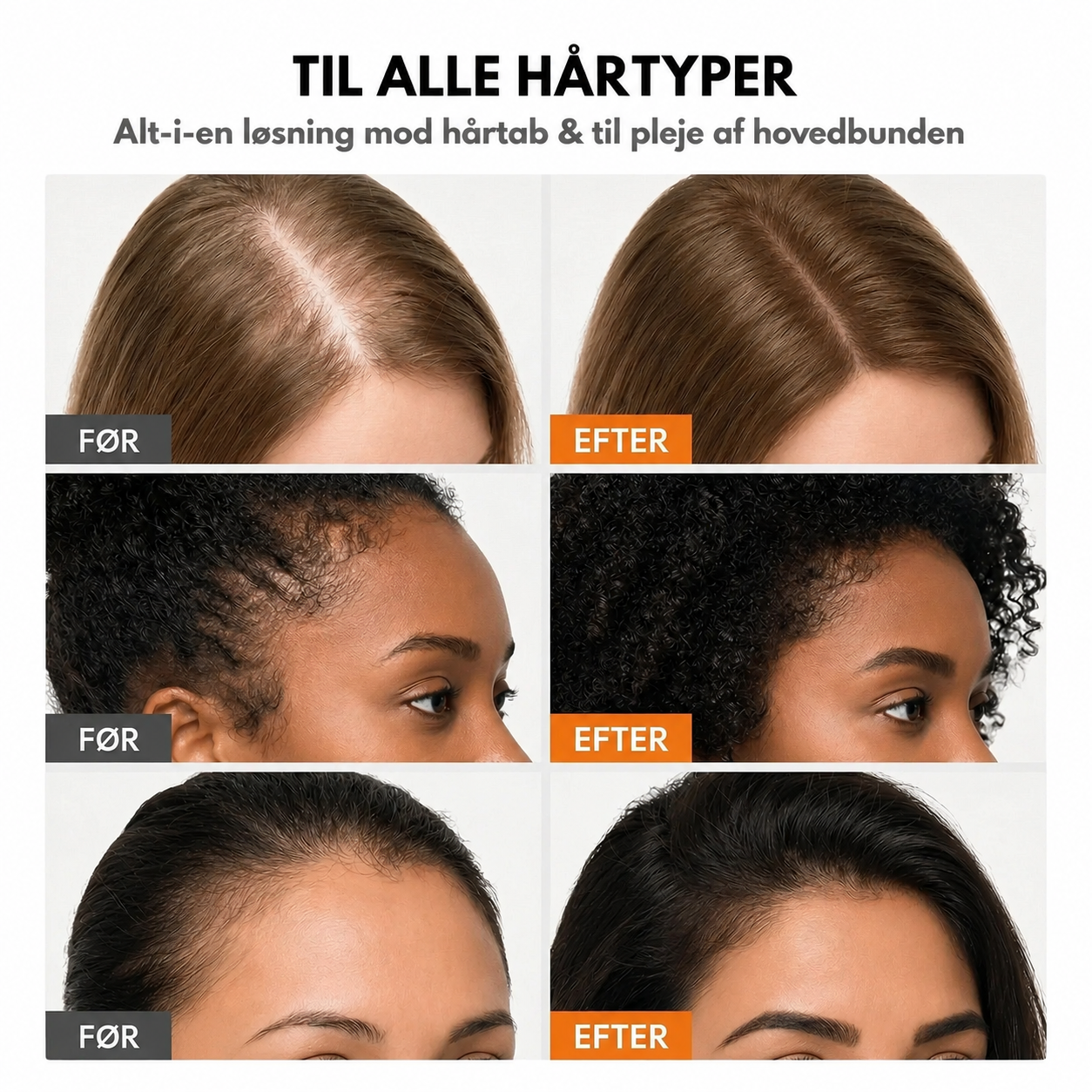 Hero Hair Growth™ Koreansk hårvækstserum