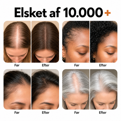 Hero Hair Growth™ Koreansk hårvækstserum