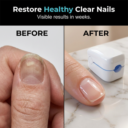NailGlow™ | Hold op med at vente på, at neglelakken tørrer